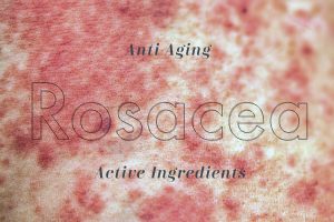 Anti-Aging Skincare for Rosacea: How to Use Active Ingredients Without Wrecking Your Skin 